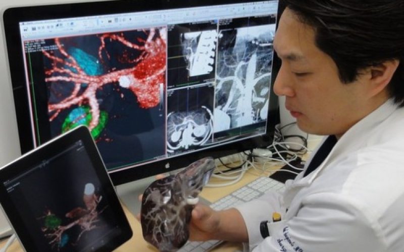 Stampa 3D e Cardiochirurgia: un connubio perfetto