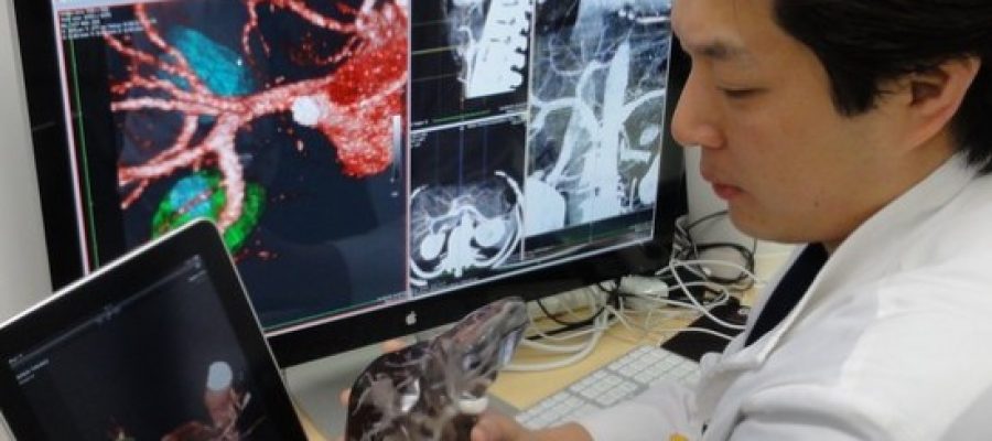 Stampa 3D e Cardiochirurgia: un connubio perfetto